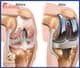 Slider image (6) Dr. Jose Manuel Hernandez - Orthopedic Surgery in Mexico